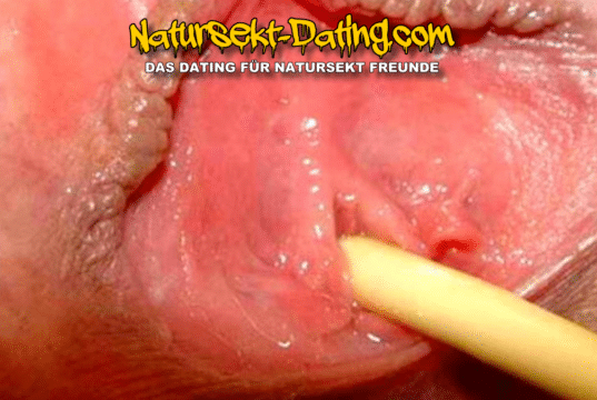 Sie steht auf Katheter Spiele und Klinik Sex.